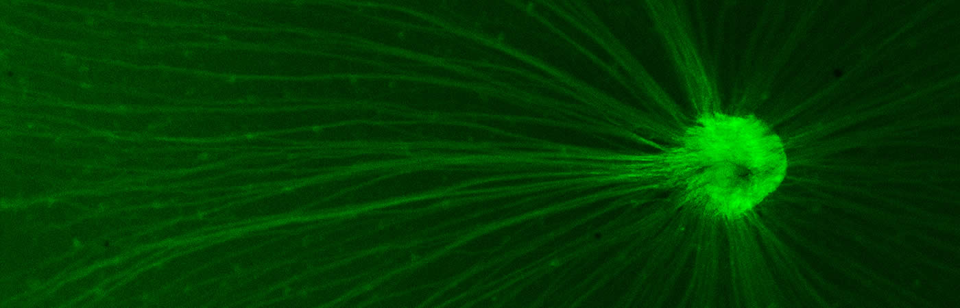 Melanopsin-expressing retinal ganglion cell axons exiting the retina (Lucas lab)