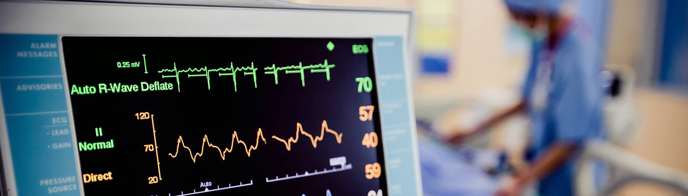 Electrocardiogram