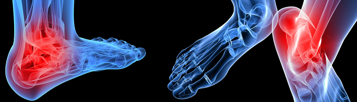 Arthritic pain in the ankle