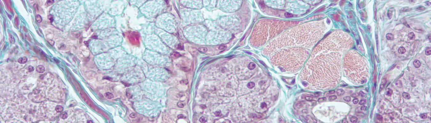 Histology of a gland