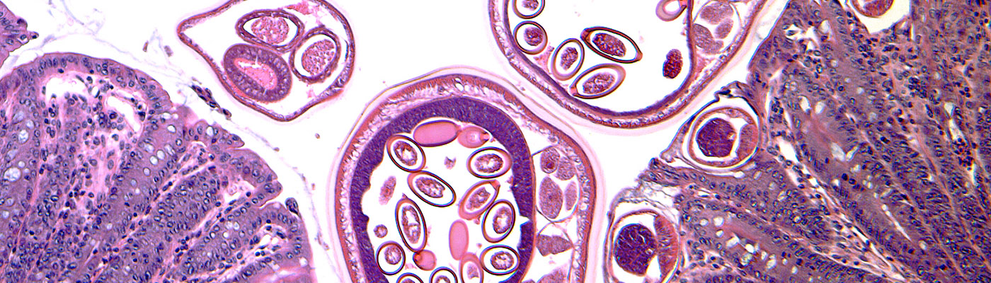 Gut infection
